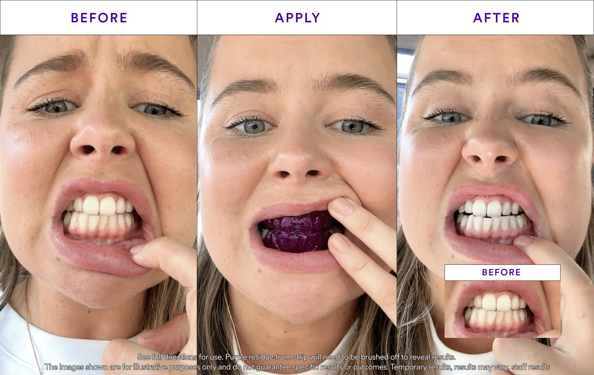 V34 Whitening Strips - Image 6